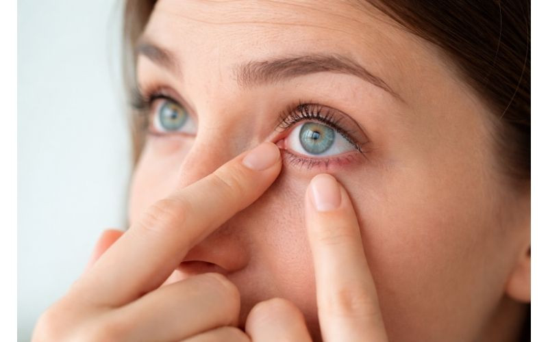 Gözünüze Yabancı Cisim Kaçtı mı? İlk 5 Dakika Neler Yapılır, Neler Yapılmaz