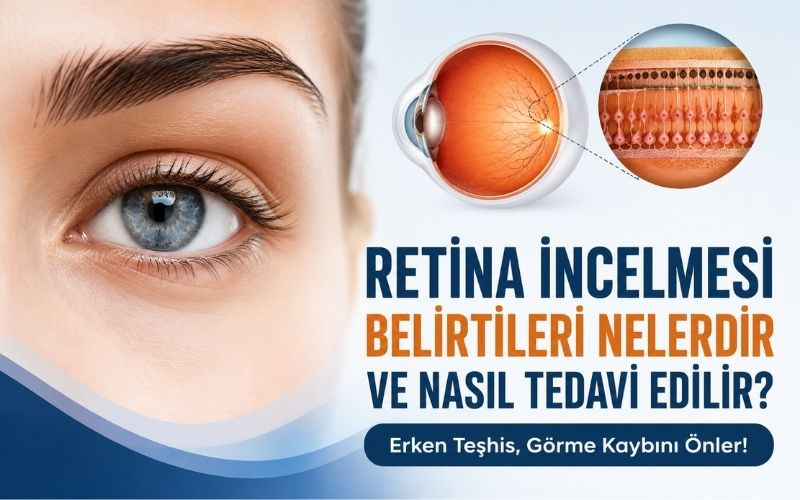 Retina İncelmesi Belirtileri Nelerdir ve Nasıl Tedavi Edilir?